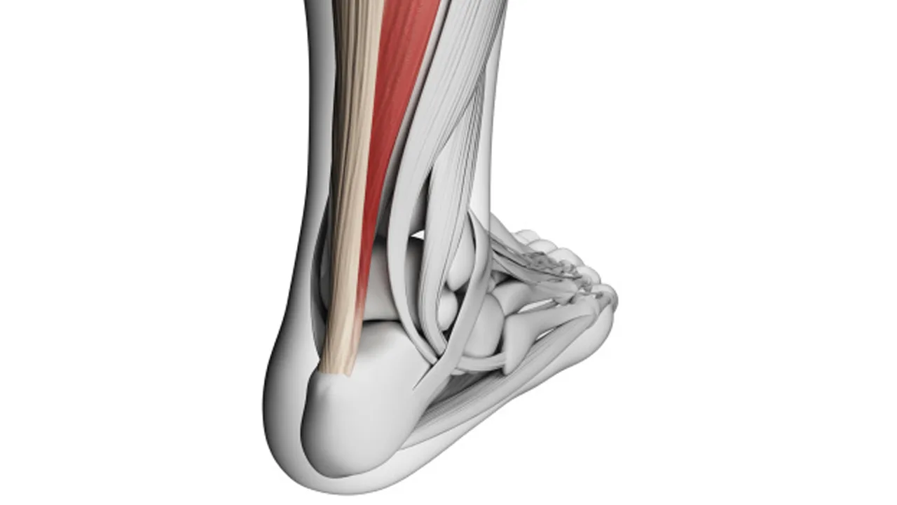 dr-mauricio-arouesty-proloterapia-que-es-la-tendinitis-2