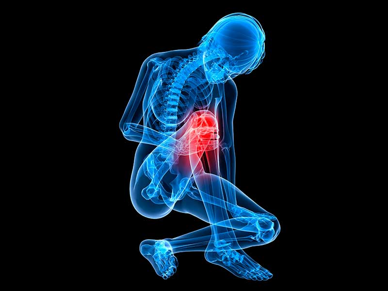 dr-mauricio-arouesty-proloterapia-como-rehabilitar-el-dolor-musculo-esqueletico-2