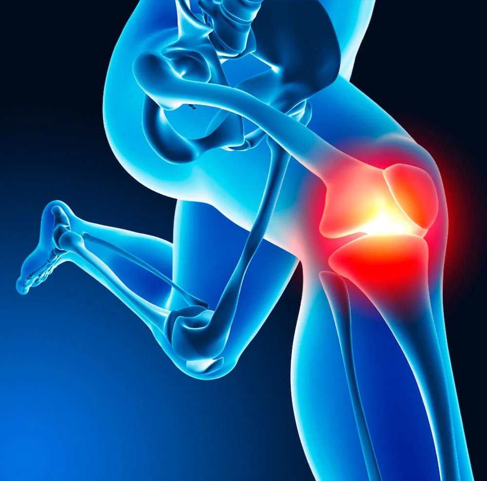 dr-mauricio-arouesty-proloterapia-desgaste-articular-de-rodillas-parte-ii-dr-mauricio-arouesty