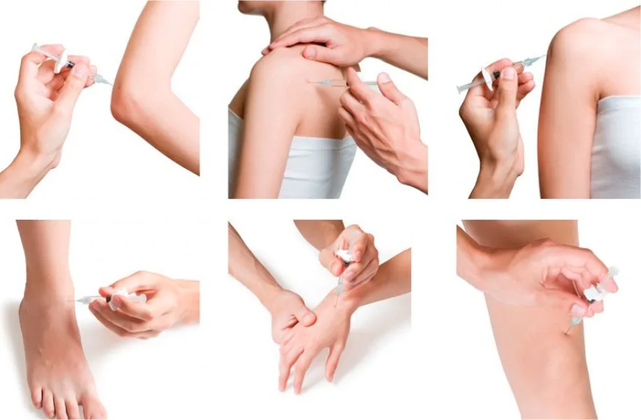 dr-mauricio-arouesty-proloterapia-como-se-lleva-a-cabo-el-tratamiento-de-la-proloterapia-parte-2-2