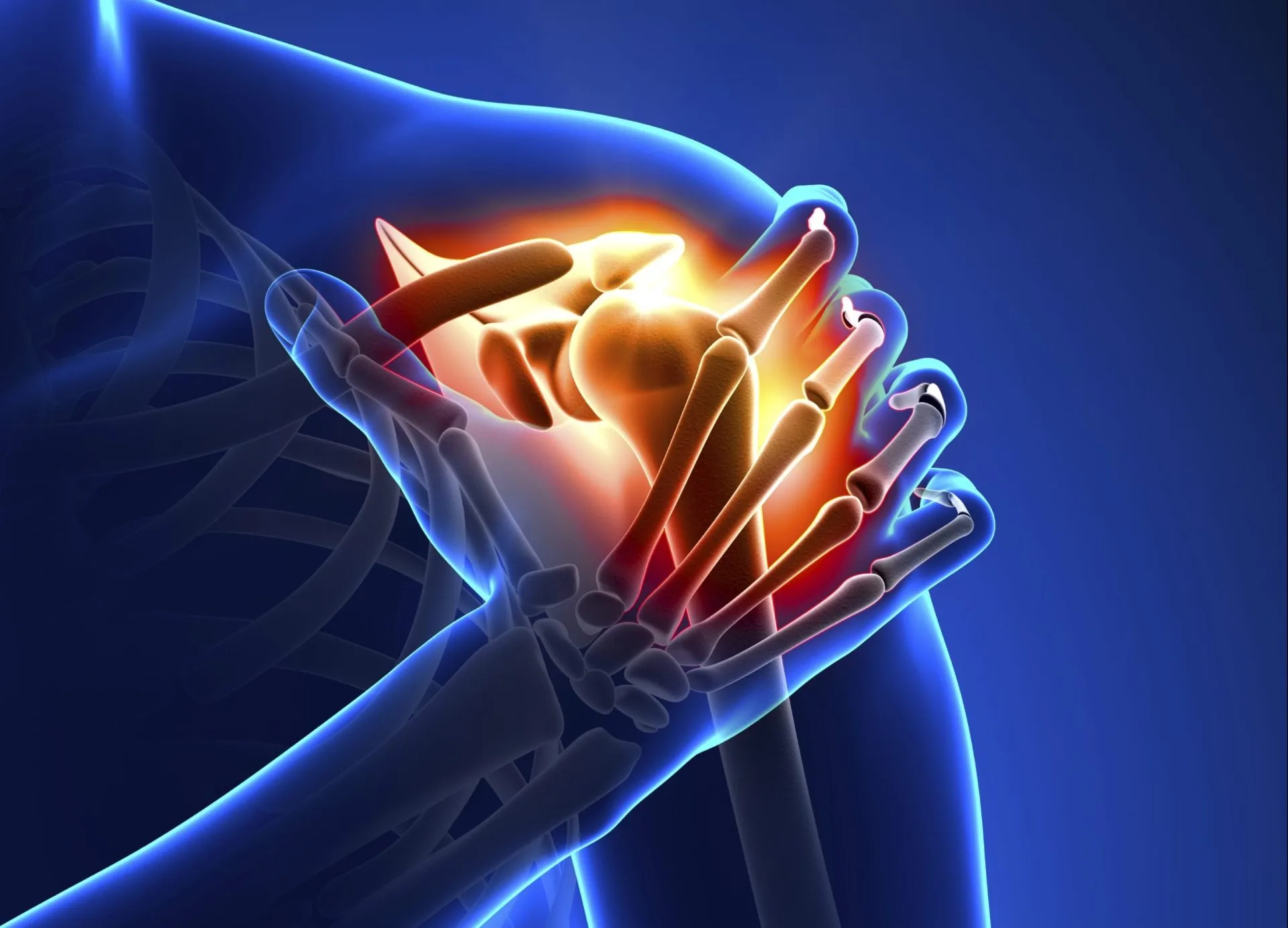 dr-mauricio-arouesty-proloterapia-rehabilitacion-del-hombro-con-proloterapia-dr-mauricio-arouesty