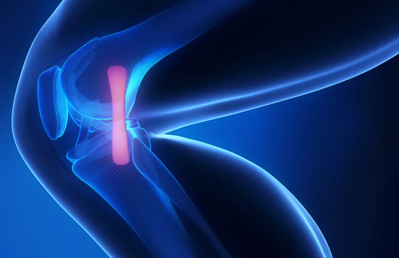 dr-mauricio-arouesty-proloterapia-la-proloterapia-es-el-mejor-tratamiento-para-las-lesiones-en-los-ligamentos-2