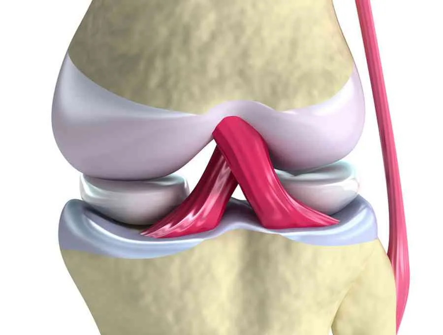 dr-mauricio-arouesty-proloterapia-como-ayuda-la-proloterapia-a-los-ligamentos-2