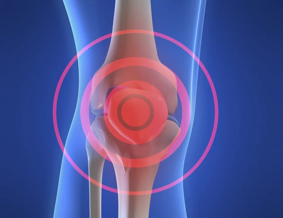 dr-mauricio-arouesty-proloterapia-que-son-las-lesiones-articulares-2