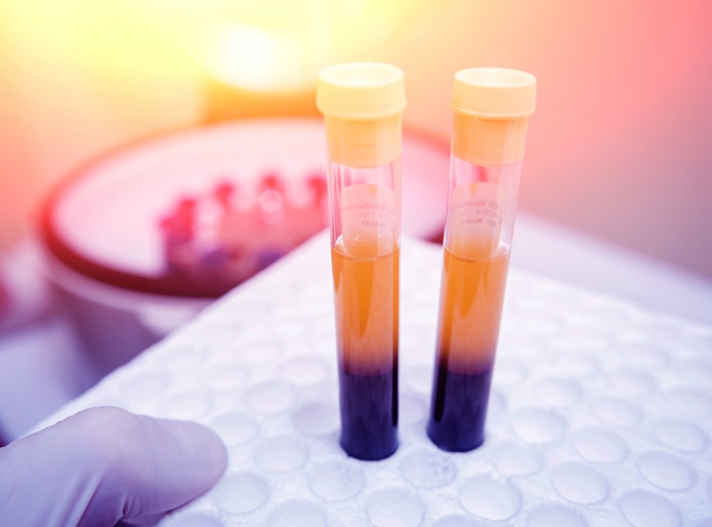 dr-mauricio-arouesty-proloterapia-plasma-rico-en-plaquetas-prp-4